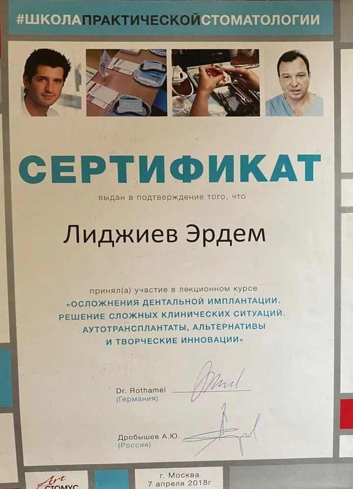 Осложнения дентальной имплантации