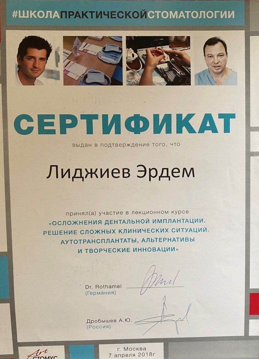 Осложнения дентальной имплантации
